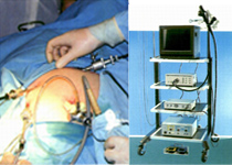 Лапароскопия